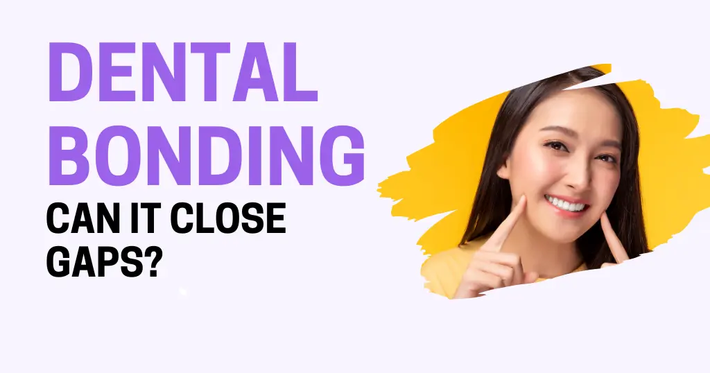 Is Dental Bonding an Effective Solution for Gaps Between Teeth in Santa Cruz?