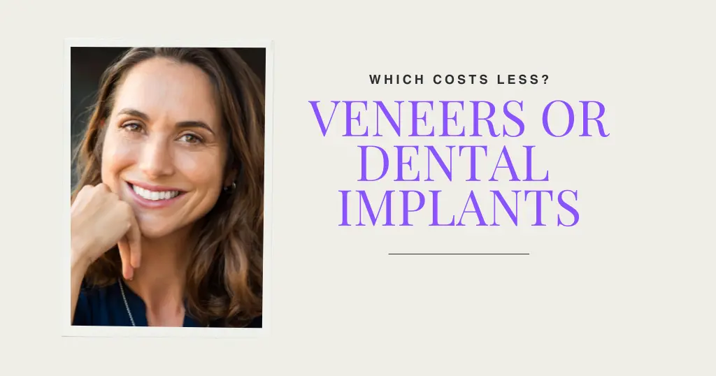 Veneers Or Implants Blog Header Image